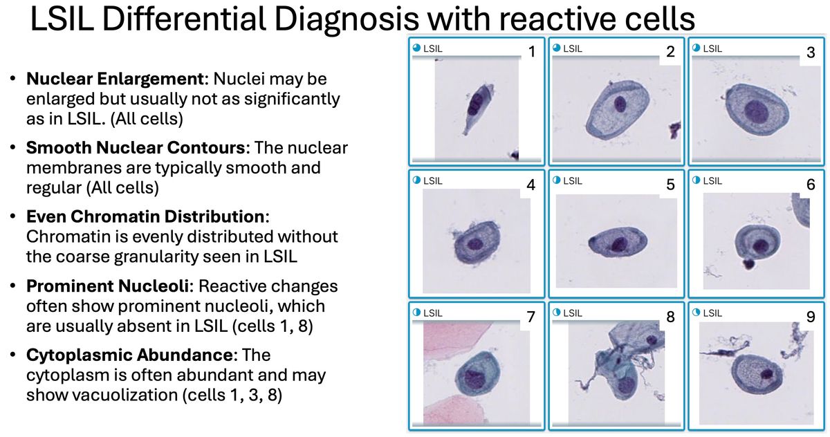 Cervical Cancer Learning Platform Release