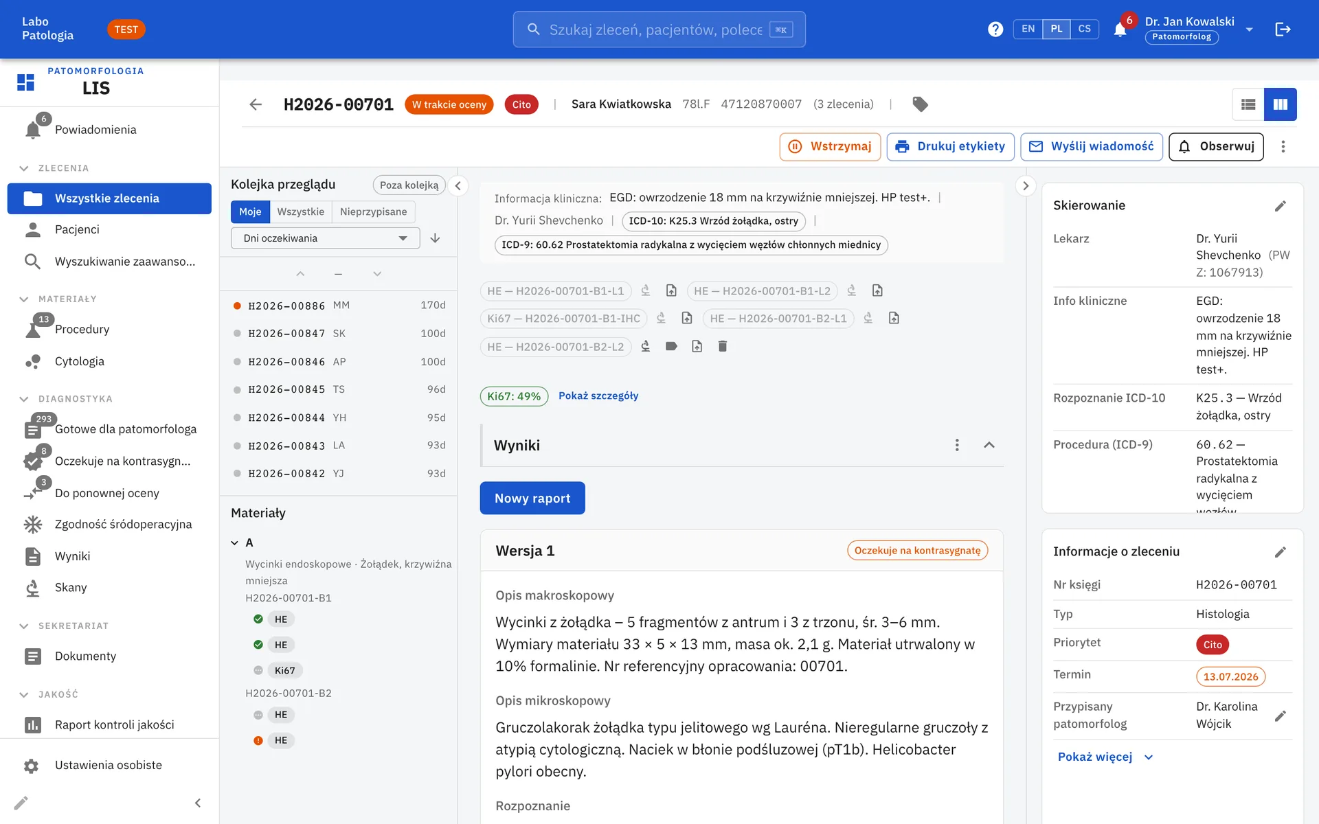 LIS NG case review view with queue, specimen tree, report editor and referral details