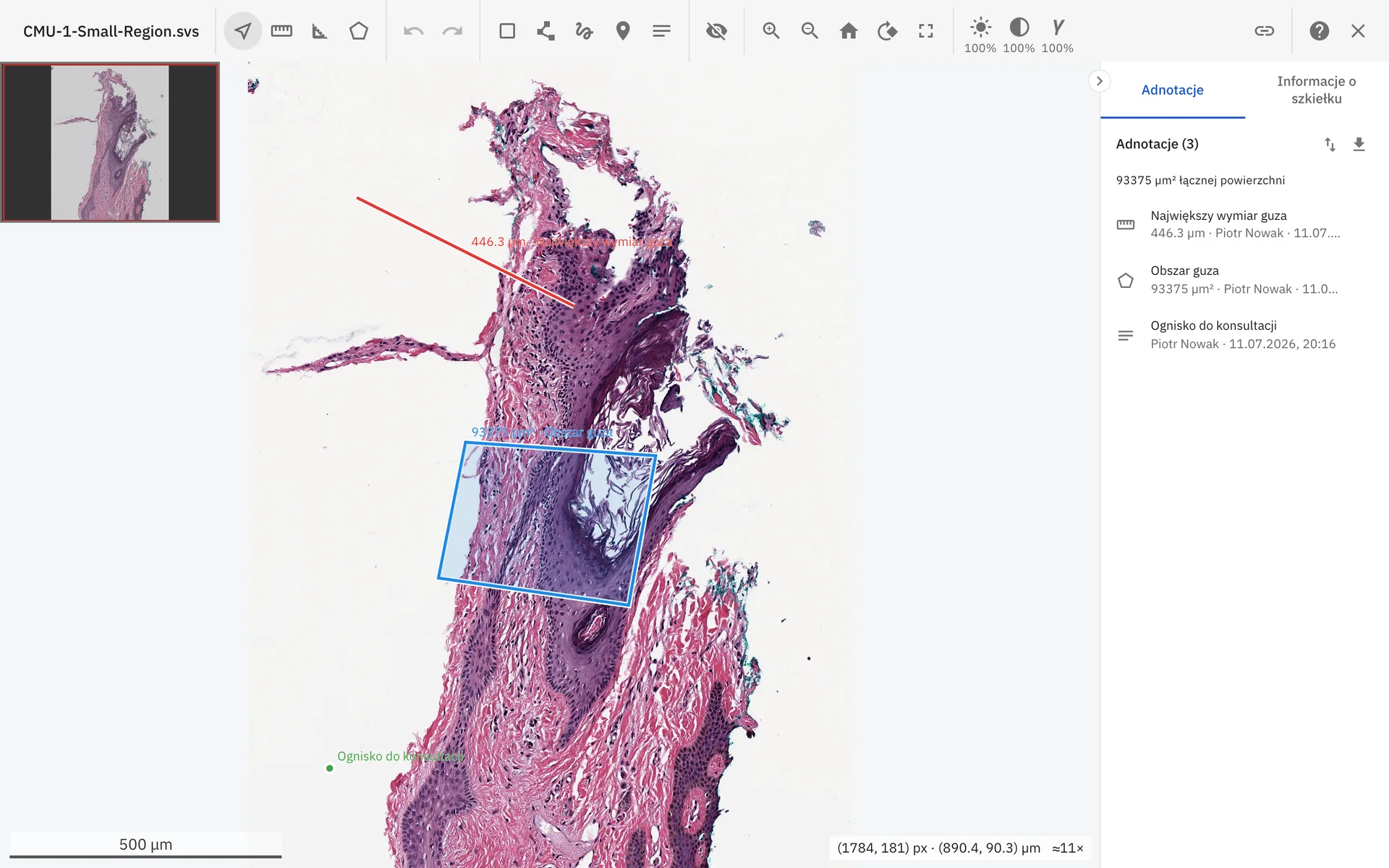 LIS NG whole-slide image viewer showing an H&E slide with annotations
