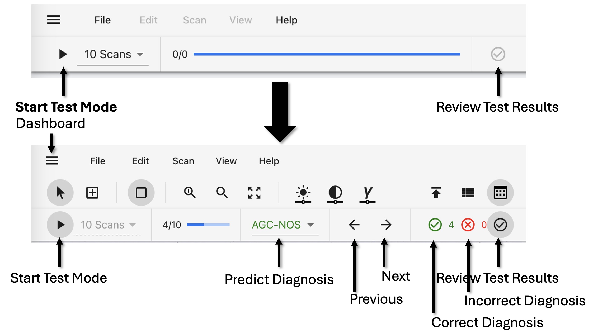 Cervical Cancer Learning Platform interface showing diagnostic training workflow