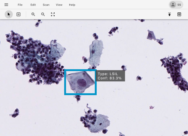 ScanAI Digital Pathology Platform Launch