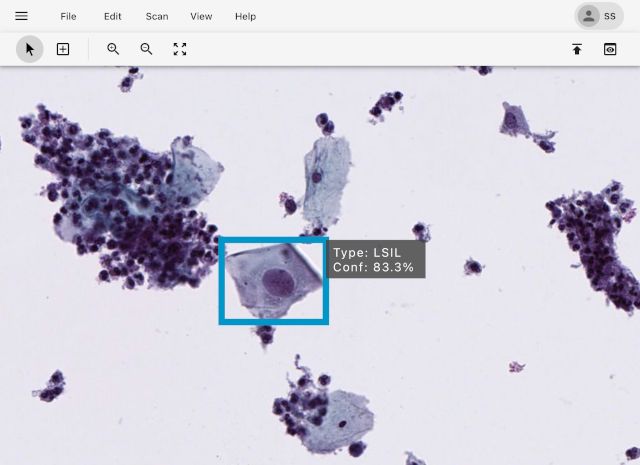 ScanAI Digital Pathology Platform Launch