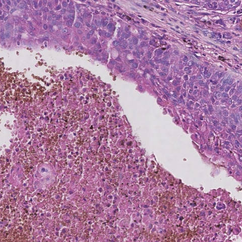 Tissue sample analysis
